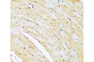 Immunohistochemistry of paraffin-embedded Mouse heart using ARL4A Polyclonal Antibody at dilution of 1:100 (40x lens). (ARL4A anticorps)
