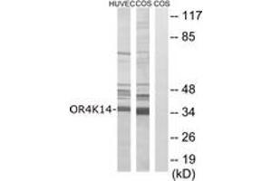 Western blot analysis of extracts from COS7/HuvEc cells, using OR4K14 Antibody. (OR4K14 anticorps  (AA 261-310))
