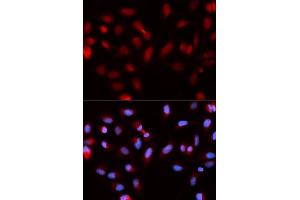 Immunofluorescence analysis of U2OS cells using BIRC5 antibody.