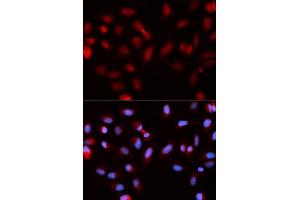 Immunofluorescence analysis of U2OS cells using BIRC5 antibody. (Survivin anticorps  (AA 1-142))