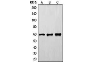Western blot analysis of FYN (pY530) expression in HeLa (A), mouse brain (B), rat brain (C) whole cell lysates. (FYN anticorps  (C-Term, pTyr530))