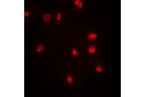 Immunofluorescent analysis of BAF57 staining in SW620 cells. (SMARCE1 anticorps)