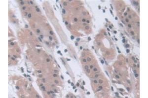 Detection of STIP1 in Human Stomach Tissue using Polyclonal Antibody to Stress Induced Phosphoprotein 1 (STIP1)