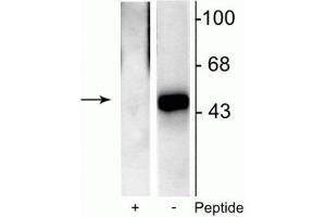 Western blot of recombinant Elk-1 showing specific immunolabeling of the ~46 kDa Elk-1 phosphorylated at Ser383 in the right lane (-). (ELK1 anticorps  (pSer383))