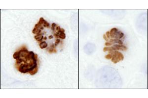 Immunohistochemistry (IHC) image for anti-Histone H3 (H3) (pSer10) antibody (ABIN7449558)