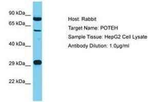 Image no. 1 for anti-POTE Ankyrin Domain Family, Member H (POTEH) (AA 421-470) antibody (ABIN6750592) (POTEH anticorps  (AA 421-470))