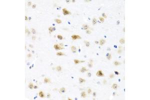 Immunohistochemistry of paraffin-embedded mouse brain using C8orf4 antibody (ABIN5975014) at dilution of 1/100 (40x lens). (C8orf4 anticorps)