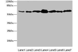 Western blot All lanes: NAE1 antibody at 1. (NAE1 anticorps  (Regulatory Subunit))