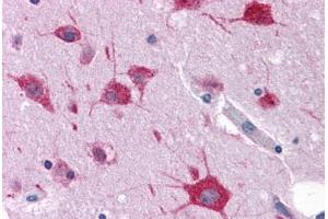 Human Brain, Cortex: Formalin-Fixed, Paraffin-Embedded (FFPE) (FAM59A anticorps  (C-Term))