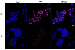 Immunocytochemical staining of HeLa cells using CLPP antibody (ABIN7798100), 1:1,000), Top panel: wild-type (WT), Bottom panal: CLPP shRNA knockdown (KD).