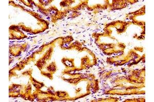 Immunohistochemistry of paraffin-embedded human prostate tissue using ABIN7154296 at dilution of 1:100 (GOLPH3 anticorps  (AA 16-150))