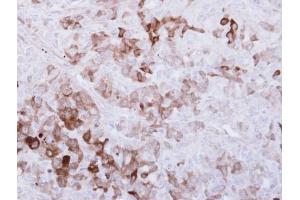 IHC-P Image Immunohistochemical analysis of paraffin-embedded DU-145 xenograft, using ALDH1A1, antibody at 1:500 dilution. (ALDH1A1 anticorps  (C-Term))