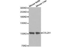 Western blot analysis of extracts of various cell lines, using COL2A1 antibody. (COL2A1 anticorps  (AA 873-1072))
