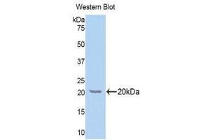 Western Blotting (WB) image for anti-Galactosylceramidase (GALC) (AA 375-535) antibody (ABIN1176550) (GALC anticorps  (AA 375-535))