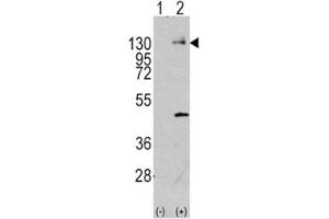 Western blot analysis of PDGFR antibody and 293 cell lysate (2 ug/lane) either nontransfected (Lane 1) or transiently transfected with the PDGFRA gene (2). (PDGFRA anticorps  (AA 698-727))