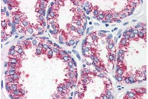 Prostate, Human: Formalin-Fixed, Paraffin-Embedded (FFPE) (CCKAR anticorps  (Internal Region))