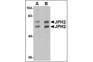 Western blot analysis of JPH2 in mouse brain tissue lysate with JPH2 antibody at (A) 1 and (B) 2 µg/ml (Junctophilin 2 anticorps  (C-Term))