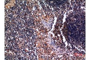 Immunohistochemistry (IHC) analysis of paraffin-embedded Human Lymph Gland, antibody was diluted at 1:100.