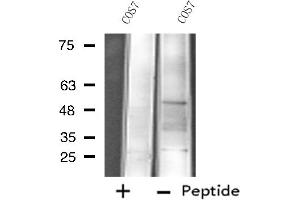 Western blot analysis of extracts from COS7 cells, using Cytochrome P450 4X1 antibody.