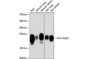 Western blot analysis of extracts of various cell lines, using HLA-DQ Rabbit mAb (1252) at 1:1000 dilution. (HLA-DQA1 anticorps)