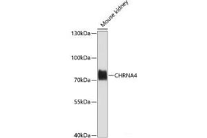 Western blot analysis of extracts of Mouse kidney using CHRNA4 Polyclonal Antibody at dilution of 1:1000. (CHRNA4 anticorps)