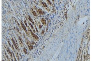 ABIN6277333 at 1/100 staining Human gastric tissue by IHC-P. (IMMT anticorps  (Internal Region))