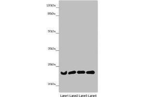 Western blot All lanes: B9D1 antibody at 6. (B9D1 anticorps  (AA 1-130))