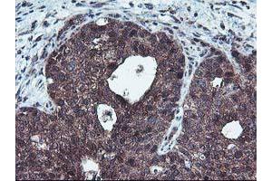 Image no. 5 for anti-Haloacid Dehalogenase-Like Hydrolase Domain Containing 1 (HDHD1) antibody (ABIN1498623) (HDHD1 anticorps)