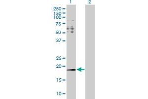 Western Blot analysis of HYI expression in transfected 293T cell line by HYI MaxPab polyclonal antibody. (HYI anticorps  (AA 1-174))