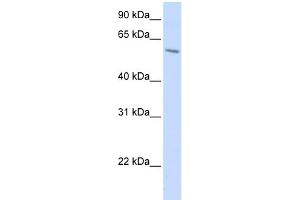 WB Suggested Anti-PORCN Antibody Titration:  0. (PORCN anticorps  (N-Term))