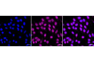 anti-Lysine (K)-Specific Demethylase 4B (KDM4B) antibody