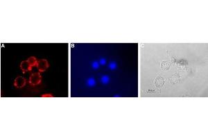 Expression of serotonin transporter in rat PC12 cells - Cell surface detection of serotonin transporter in live intact rat pheochromocytoma PC12 cells.