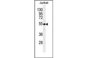 Western blot analysis of  RBPJL Antibody (N-term) in Jurkat cell line lysates (35ug/lane).