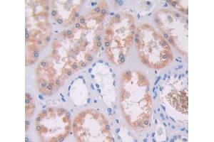Used in DAB staining on fromalin fixed paraffin- embedded Kidney tissue