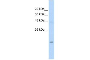 WB Suggested Anti-HIP2 Antibody Titration:  5. (UBE2K anticorps  (N-Term))