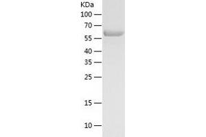 Western Blotting (WB) image for Karyopherin alpha 2 (RAG Cohort 1, Importin alpha 1) (KPNA2) (AA 1-529) protein (His-IF2DI Tag) (ABIN7123665)