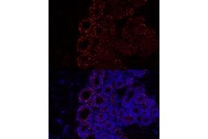Immunofluorescence analysis of Mouse brown adipose using Perilipin-2 antibody (ABIN7269220) at dilution of 1:100 (40x lens).