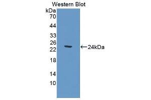 Figure. (CNDP1 anticorps  (AA 332-507))
