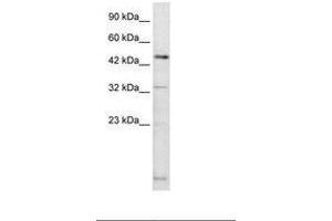Image no. 1 for anti-DMRT-Like Family A2 (DMRTA2) (AA 247-296) antibody (ABIN6735877) (DMRTA2 anticorps  (AA 247-296))
