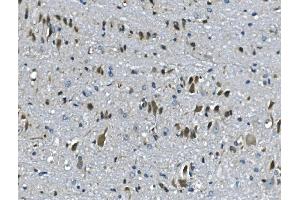 IHC analysis of PAR4/Pawr using anti-PAR4/Pawr antibody (ABIN7599938). (PAWR anticorps  (AA 13-333))