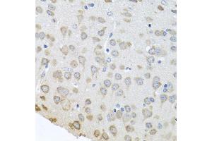 Immunohistochemistry of paraffin-embedded mouse brain using PABPC4 antibody (ABIN5973544) at dilution of 1/100 (40x lens). (PABPC4 anticorps)