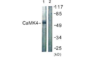Immunohistochemistry analysis of paraffin-embedded human brain tissue using CaMK4 (Ab-196/200) antibody. (CAMK4 anticorps  (Thr196))