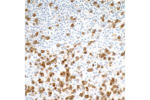 Immunohistochemistry (IHC) image for anti-Integrin alpha M (ITGAM) (AA 17-334) antibody (ABIN7453958)