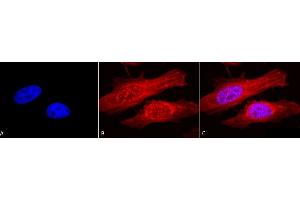 Immunocytochemistry/Immunofluorescence analysis using Rabbit Anti-Alpha B Crystallin Polyclonal Antibody (ABIN361836 and ABIN361837). (CRYAB anticorps)