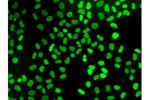 Immunofluorescence analysis of U2OS cells using TMPO antibody. (Thymopoietin anticorps)