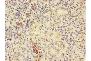 Immunohistochemistry of paraffin-embedded human pancreatic tissue using ABIN7148714 at dilution of 1:100 (CTP Synthase anticorps  (AA 300-554))