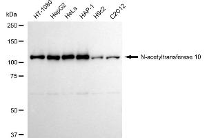 Western blotting analysis using N-acetyltransferase 10 antibody (ABIN7799531).