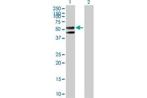 Western Blot analysis of CPM expression in transfected 293T cell line by CPM MaxPab polyclonal antibody.