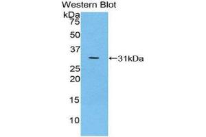 Western Blotting (WB) image for anti-Inhibitory Subunit of NF-KappaB zeta (AA 414-654) antibody (ABIN1859324) (Inhibitory Subunit of NF-KappaB zeta (AA 414-654) anticorps)
