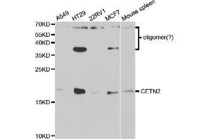 Western Blotting (WB) image for anti-Centrin, EF-Hand Protein, 2 (CETN2) antibody (ABIN1876585) (CETN2 anticorps)